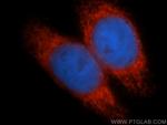 RCN2 Antibody in Immunocytochemistry (ICC/IF)