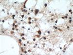 RCN2 Antibody in Immunohistochemistry (Paraffin) (IHC (P))
