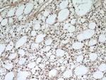 RCN2 Antibody in Immunohistochemistry (Paraffin) (IHC (P))