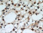RCN2 Antibody in Immunohistochemistry (Paraffin) (IHC (P))