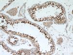 RCN2 Antibody in Immunohistochemistry (Paraffin) (IHC (P))
