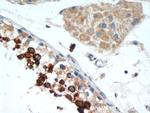 RCN2 Antibody in Immunohistochemistry (Paraffin) (IHC (P))