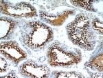 RCN2 Antibody in Immunohistochemistry (Paraffin) (IHC (P))