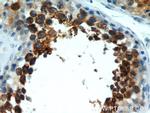 RCN2 Antibody in Immunohistochemistry (Paraffin) (IHC (P))