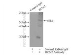 RCN2 Antibody in Immunoprecipitation (IP)