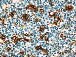 CAPG Antibody in Immunohistochemistry (Paraffin) (IHC (P))