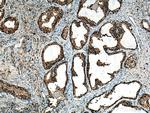 CAPG Antibody in Immunohistochemistry (Paraffin) (IHC (P))