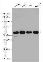 WTAP Antibody in Western Blot (WB)