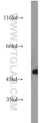 WTAP Antibody in Western Blot (WB)
