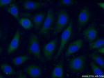 ARL4C Antibody in Immunocytochemistry (ICC/IF)