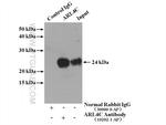 ARL4C Antibody in Immunoprecipitation (IP)