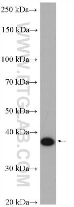 DUSP11 Antibody in Western Blot (WB)