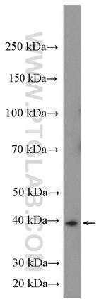 DUSP11 Antibody in Western Blot (WB)