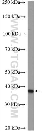 DUSP11 Antibody in Western Blot (WB)