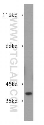 DUSP11 Antibody in Western Blot (WB)