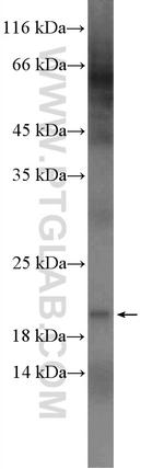 UBE2V1 Antibody in Western Blot (WB)