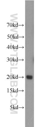 UBE2V1 Antibody in Western Blot (WB)