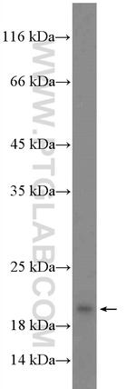 UBE2V1 Antibody in Western Blot (WB)