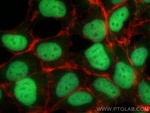 CIRBP Polyclonal Antibody