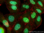 CIRBP Antibody in Immunocytochemistry (ICC/IF)