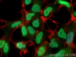 CIRBP Antibody in Immunocytochemistry (ICC/IF)