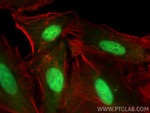 CIRBP Antibody in Immunocytochemistry (ICC/IF)