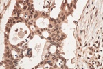 CIRBP Antibody in Immunohistochemistry (Paraffin) (IHC (P))