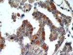 RUVBL1 Antibody in Immunohistochemistry (Paraffin) (IHC (P))