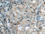 RABEPK/p40 Antibody in Immunohistochemistry (Paraffin) (IHC (P))