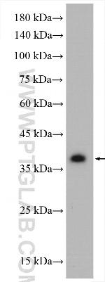 RABEPK/p40 Antibody in Western Blot (WB)