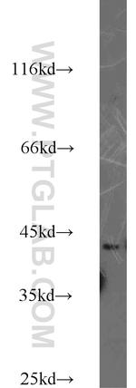RABEPK/p40 Antibody in Western Blot (WB)