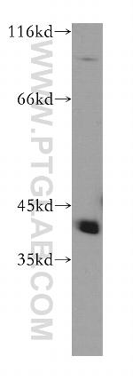 RABEPK/p40 Antibody in Western Blot (WB)