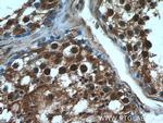 TSC22D1 Antibody in Immunohistochemistry (Paraffin) (IHC (P))