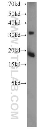 TSC22D1 Antibody in Western Blot (WB)