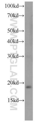 TSC22D1 Antibody in Western Blot (WB)