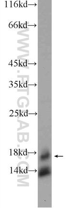 TSC22D1 Antibody in Western Blot (WB)