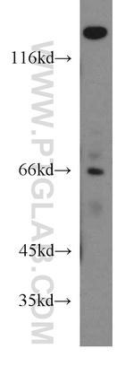 FANCG Antibody in Western Blot (WB)
