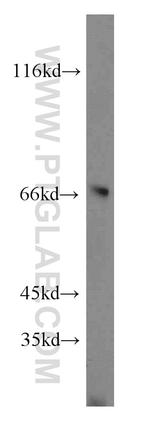 FANCG Antibody in Western Blot (WB)