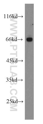 FANCG Antibody in Western Blot (WB)