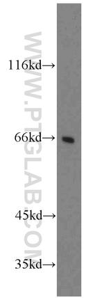 FANCG Antibody in Western Blot (WB)