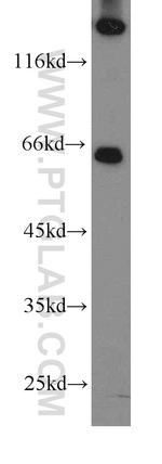 FANCG Antibody in Western Blot (WB)