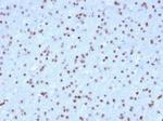 OLIG2 (Marker of Glial Brain Tumors) Monoclonal Antibody (OLIG2/2400)