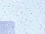 OLIG2 (Marker of Glial Brain Tumors) Antibody in Immunohistochemistry (Paraffin) (IHC (P))