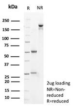 OLIG2 (Marker of Glial Brain Tumors) Antibody in SDS-PAGE (SDS-PAGE)