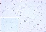 OLIG2 (Marker of Glial Brain Tumors) Recombinant Rabbit Monoclonal Antibody (OLIG2/6695R)