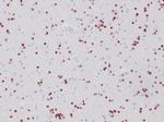 OLIG2 (Marker of Glial Brain Tumors) Antibody in Immunohistochemistry (Paraffin) (IHC (P))