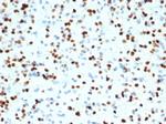 OLIG2 (Marker of Glial Brain Tumors) Recombinant Rabbit Monoclonal Antibody (OLIG2/7074R)