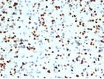 OLIG2 (Marker of Glial Brain Tumors) Recombinant Rabbit Monoclonal Antibody (OLIG2/7074R)