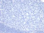 OLIG2 (Marker of Glial Brain Tumors) Recombinant Rabbit Monoclonal Antibody (OLIG2/7366R)