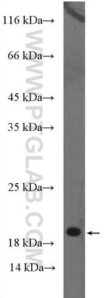 Chemerin Antibody in Western Blot (WB)